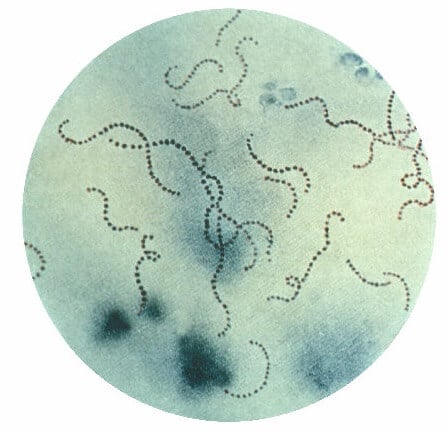 Streptococcus pyogenes Morphology