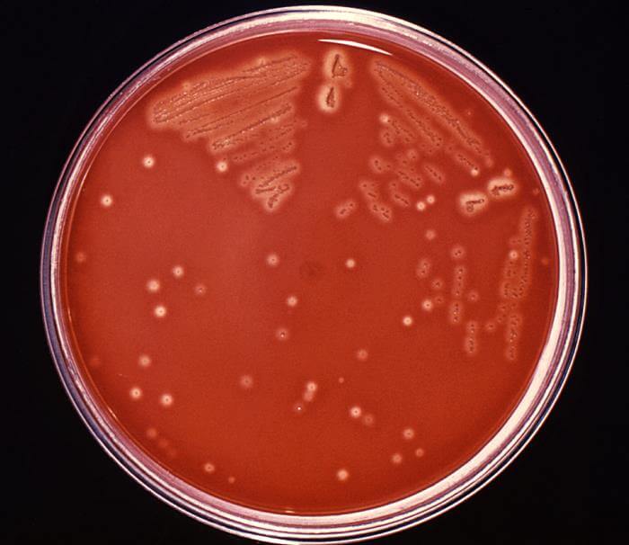 Streptococcus pyogenes-inoculated trypticase soy agar containing 5% defibrinated sheep's blood