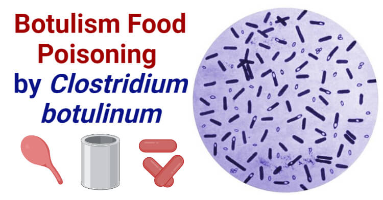 Botulism Food Poisoning by Clostridium botulinum