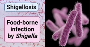 Food-borne infection by Shigella- Shigellosis