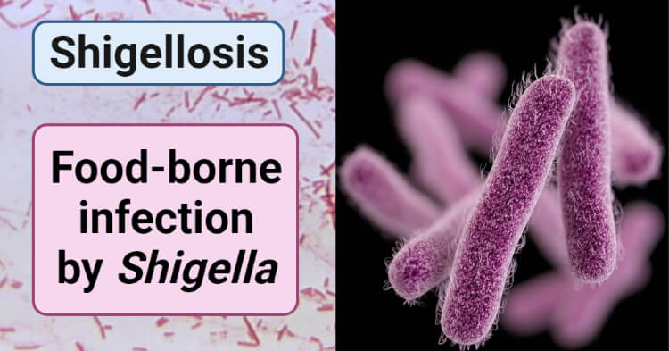 Food-borne infection by Shigella- Shigellosis