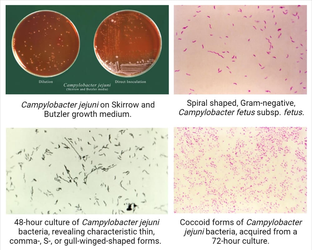 Campylobacter- Morphology and Colony Characteristics