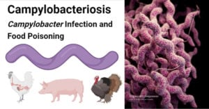 Campylobacteriosis- Campylobacter Infection and Food Poisoning