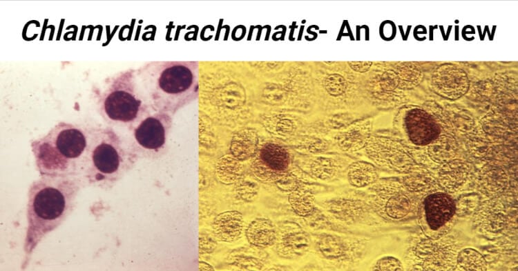 Chlamydia Trachomatis An Overview Microbe Notes