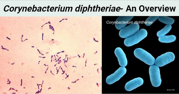 diphtheria bacteria structure
