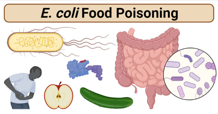 E. coli Food Poisoning