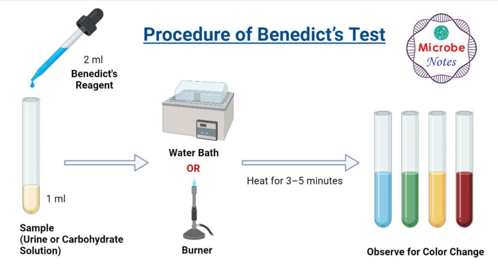 Procedure of Benedict's Test
