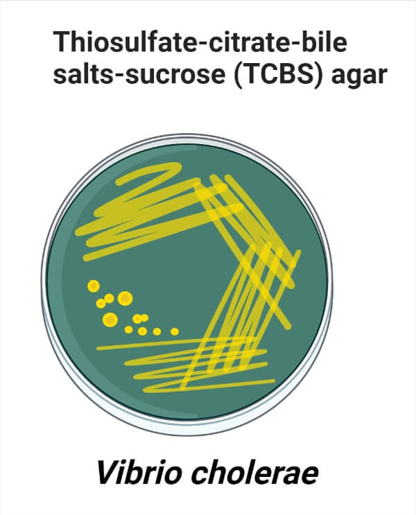 Vibrio cholerae on TCBS Agar