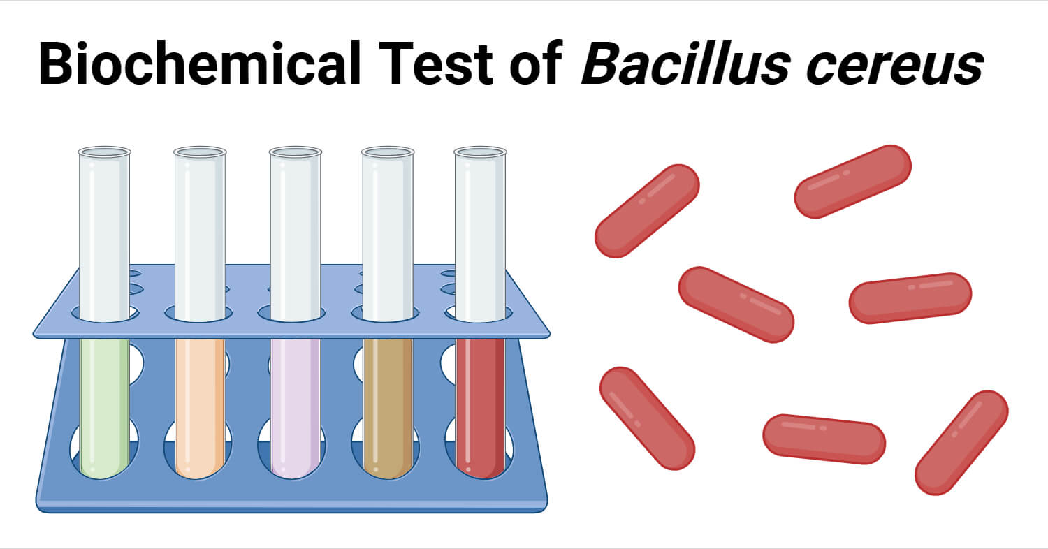 Biochemical Test of Bacillus cereus