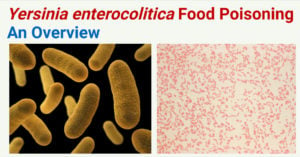 Yersinia enterocolitica Food Poisoning (Yersiniosis)
