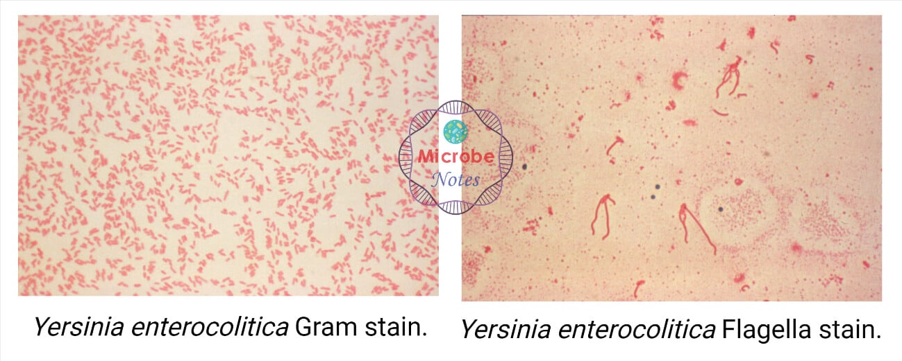 Yersinia enterocolitica- Gram Stain and Flagella Stain