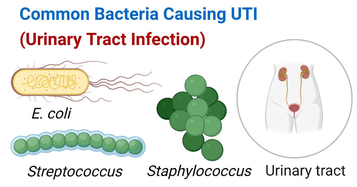 Common Bacteria Causing UTI (Urinary Tract Infection)