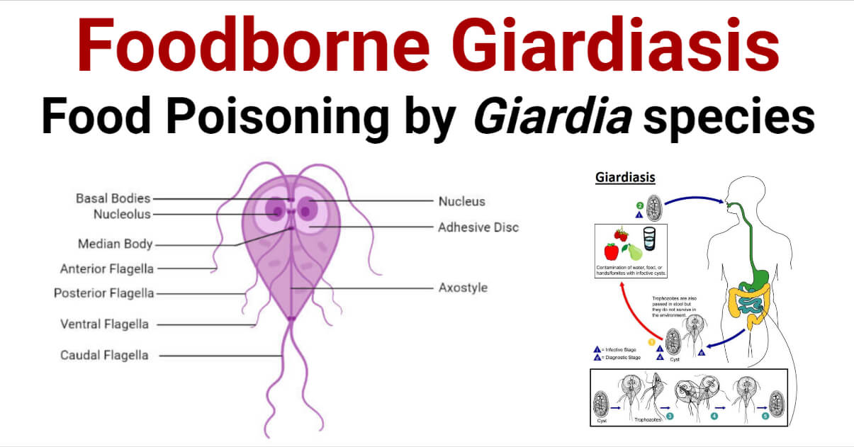 Foodborne Giardiasis- Food Poisoning by Giardia species