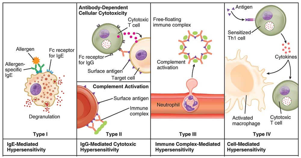 Types of Hypersensitivity Reactions