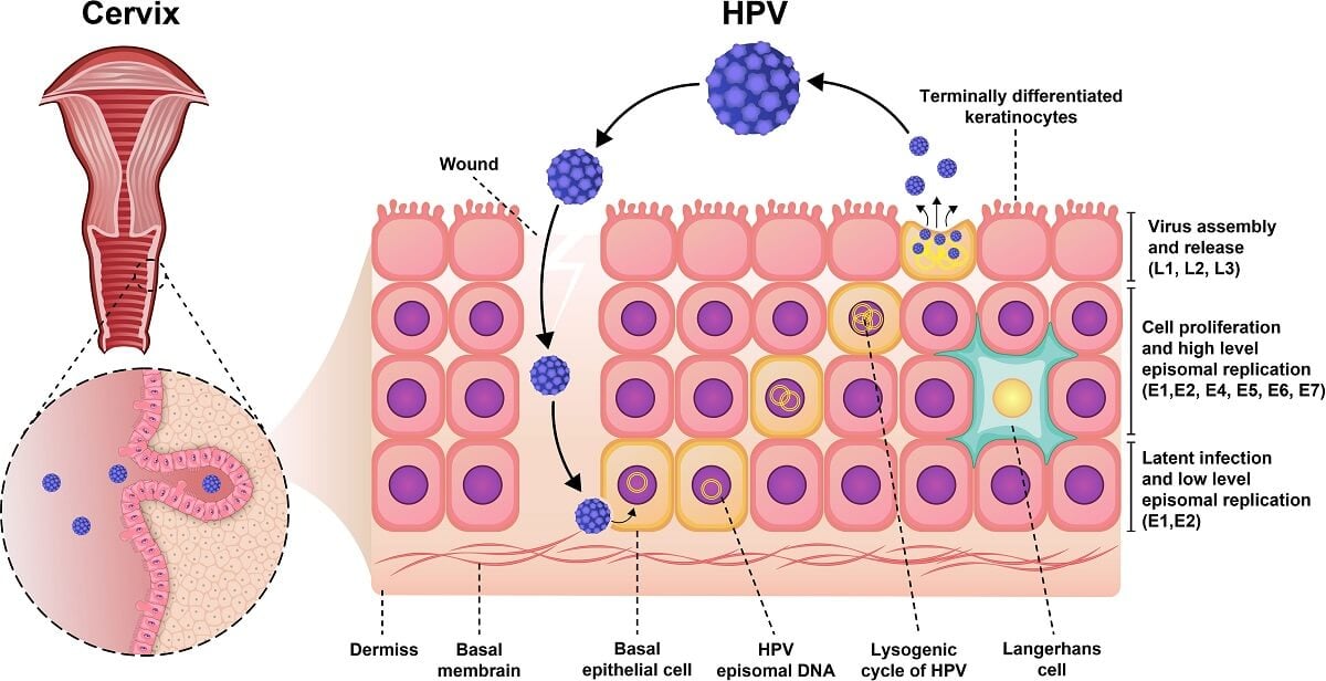 Pathogenesis of Human Papillomavirus (HPV)