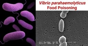 Vibrio parahaemolyticus Food Poisoning