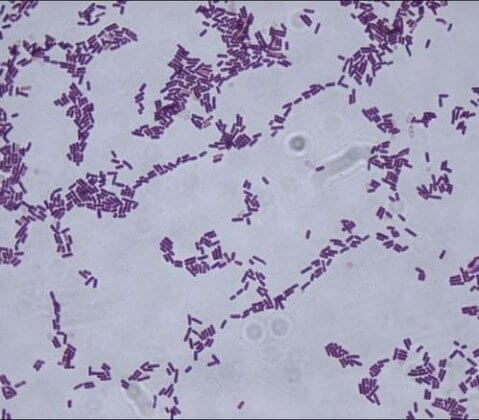 Bacillus subtilis- An Overview and Applications