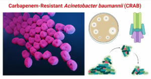Carbapenem-Resistant Acinetobacter baumannii (CRAB)