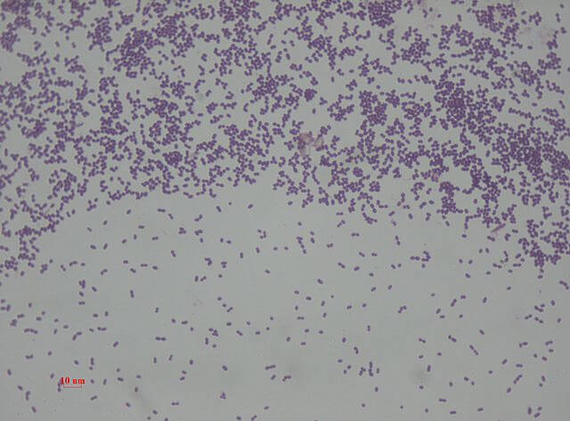 Enterococcus faecalis gram stain