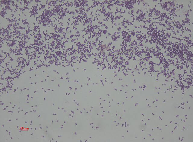 streptococcus faecalis gram stain