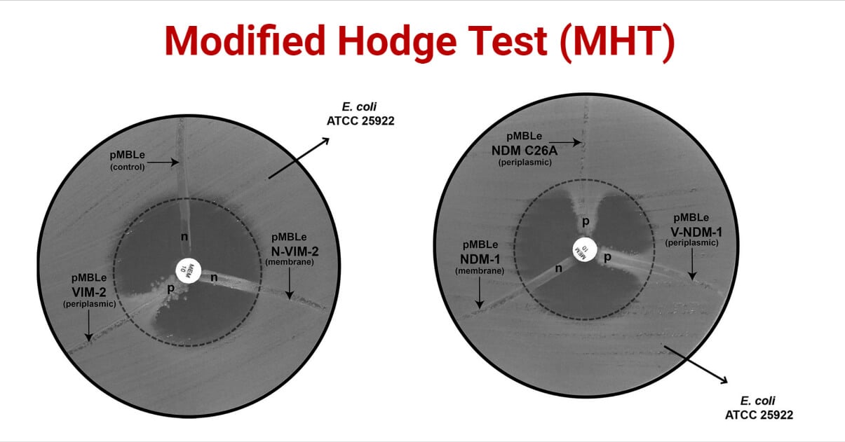 Modified Hodge Test (MHT)