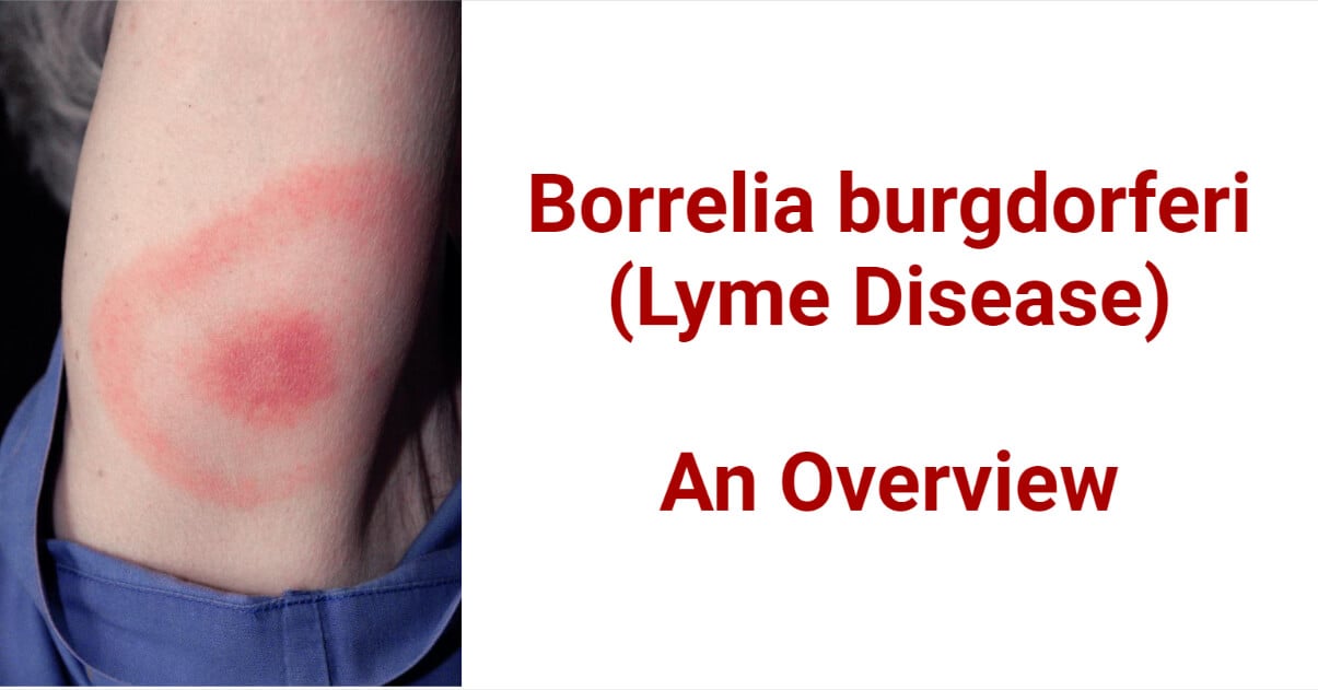 Borrelia burgdorferi (Lyme Disease)