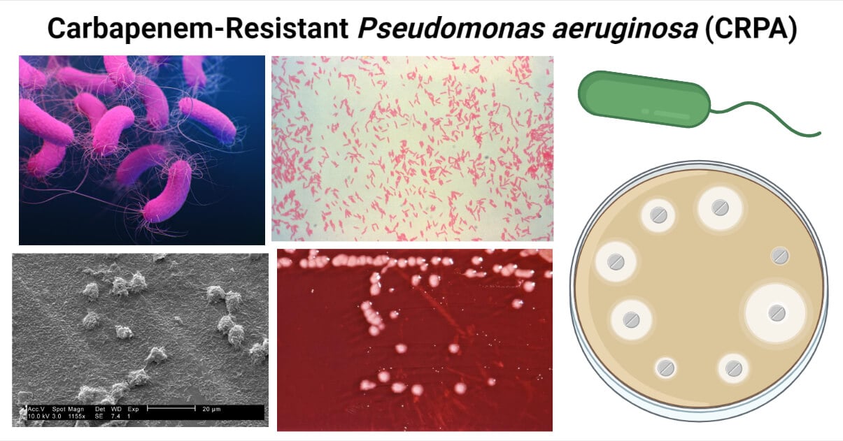 Carbapenem-Resistant Pseudomonas aeruginosa (CRPA)