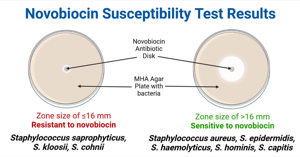 Result Interpretation of Novobiocin Susceptibility Test