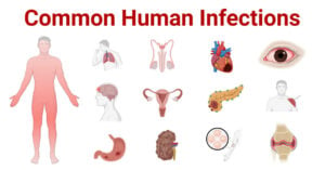 Common Human Infections and Causative Agents