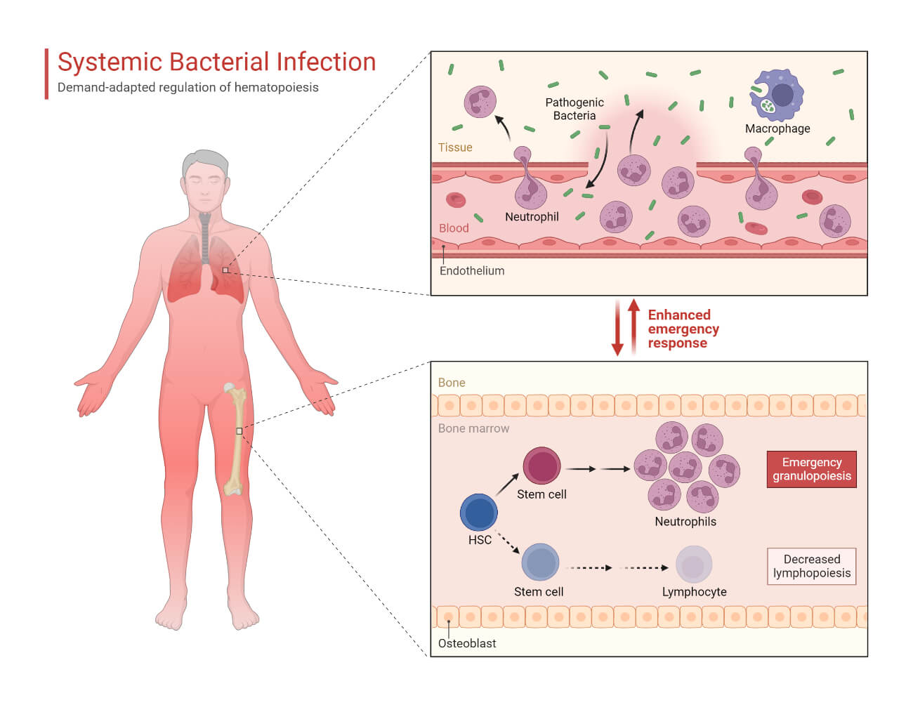 Systemic Bacterial Infection