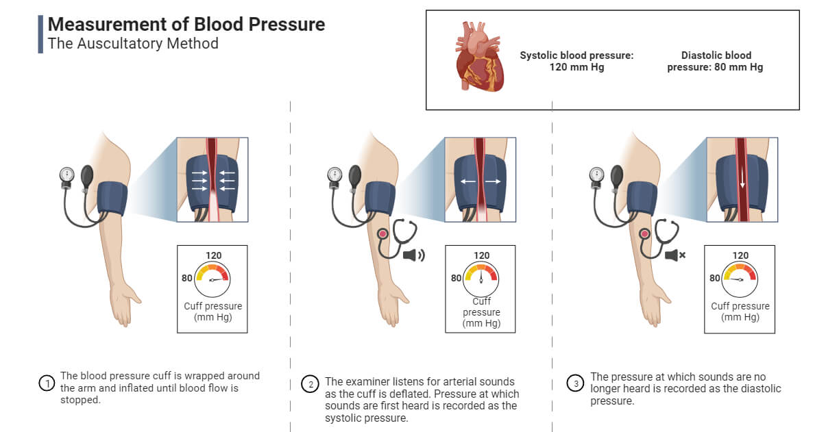 Blood Pressure Definition Measurement Mechanism