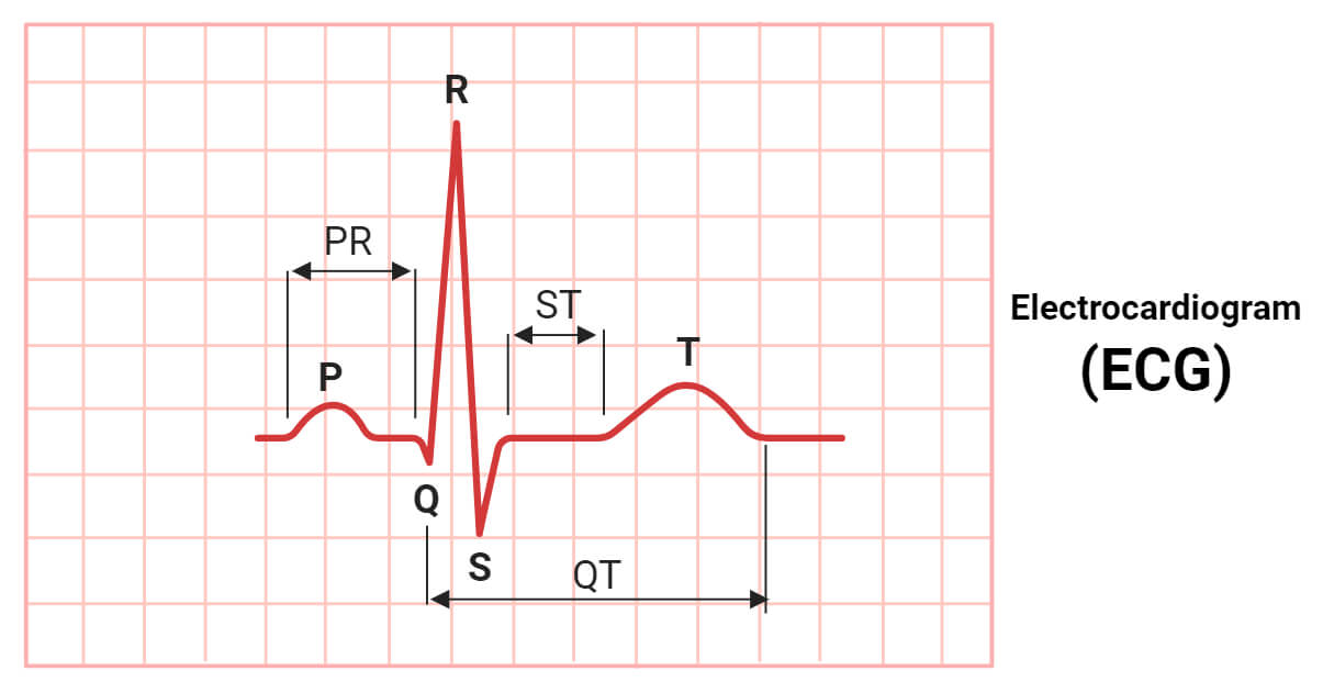 Electrocardiogram ECG Understanding Heart s Electrical Activity Electrocardiogram ECG Understanding Heart s Electrical Activity