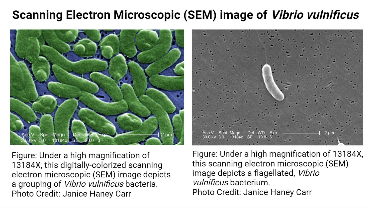 Scanning Electron Microscopic (SEM) image of Vibrio vulnificus