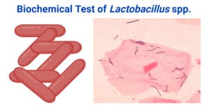 Biochemical Test of Lactobacillus spp.