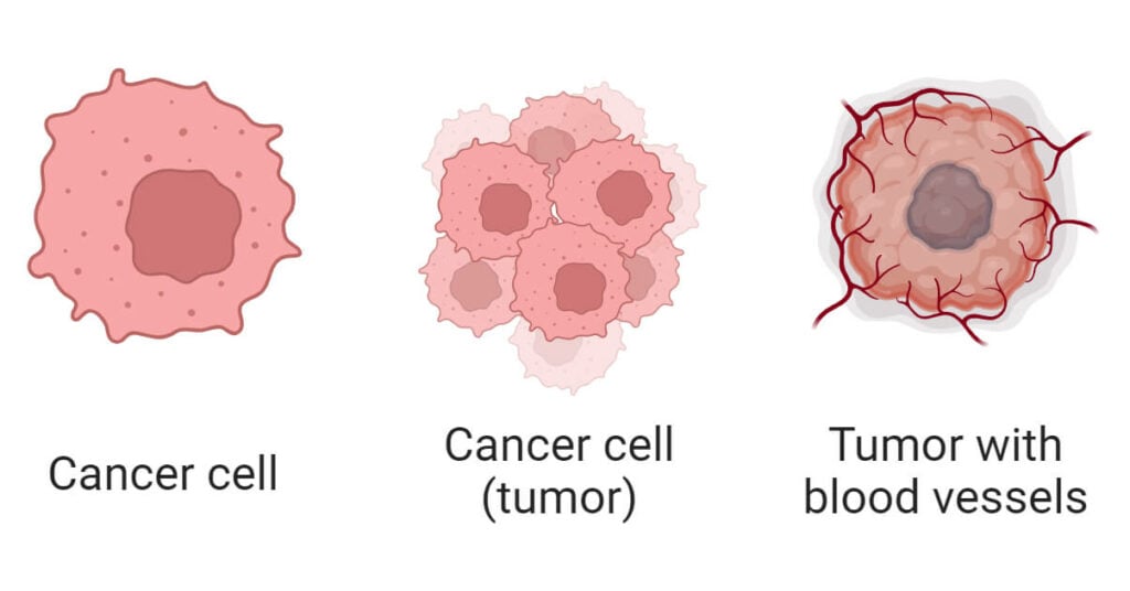 Cancer Cells: Definition, Morphology, Types, Development