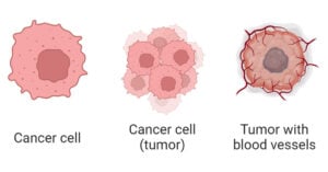 Cancer Cells