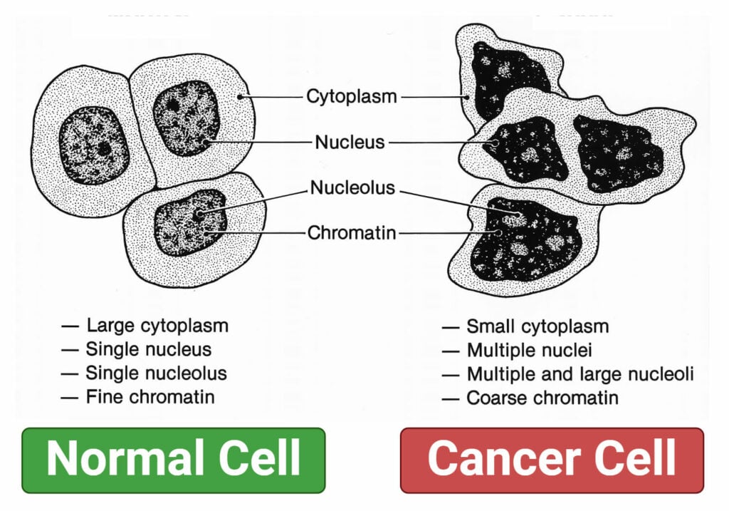 Which Of The Following Are Characteristics Of Cancer Cells Cancer Cells: Definition, Morphology, Types, Development
