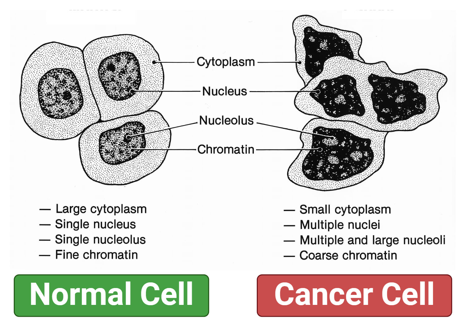 Morphology of Cancer Cells