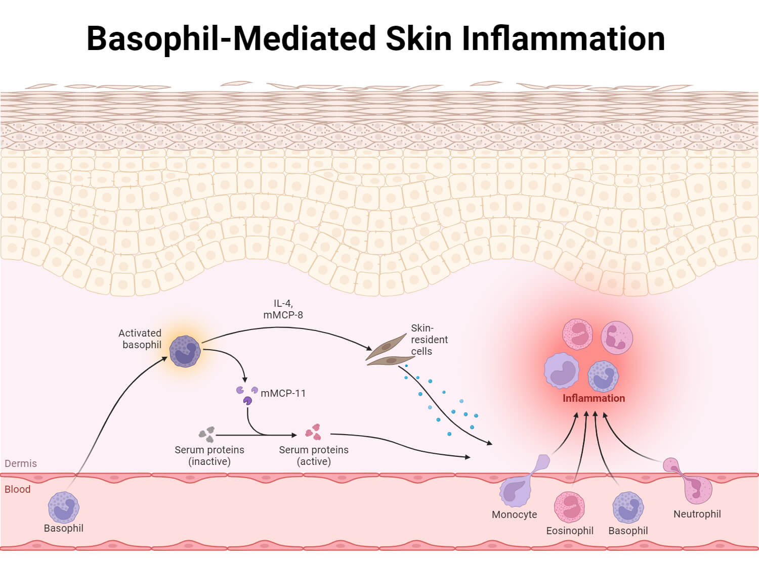 Basophil-Mediated Skin Inflammation