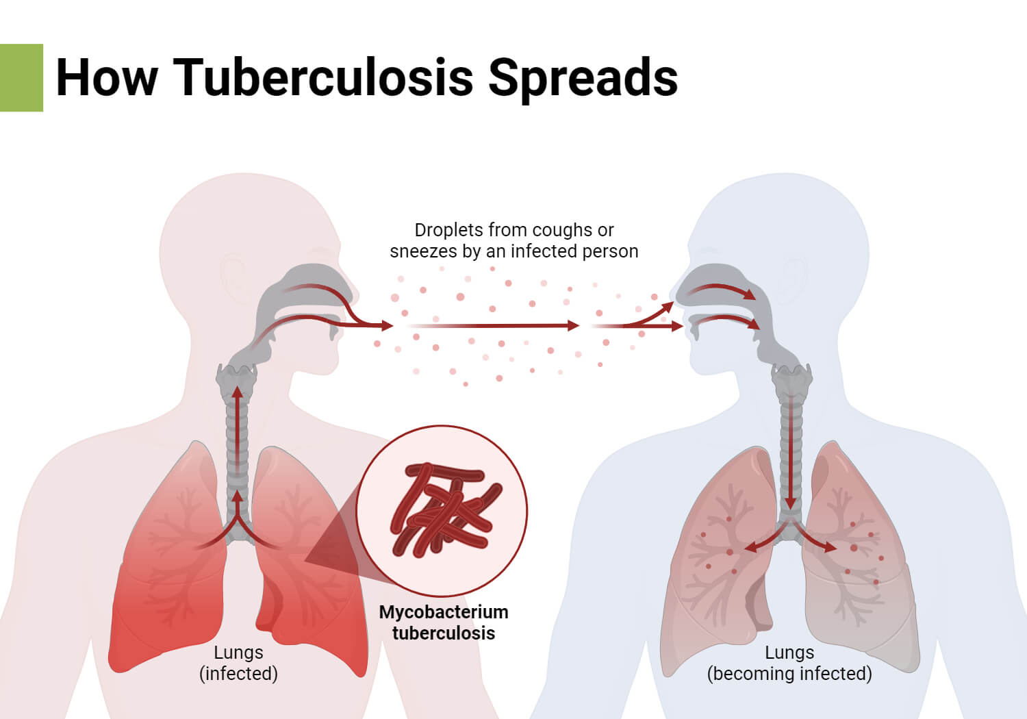 How Tuberculosis Spreads