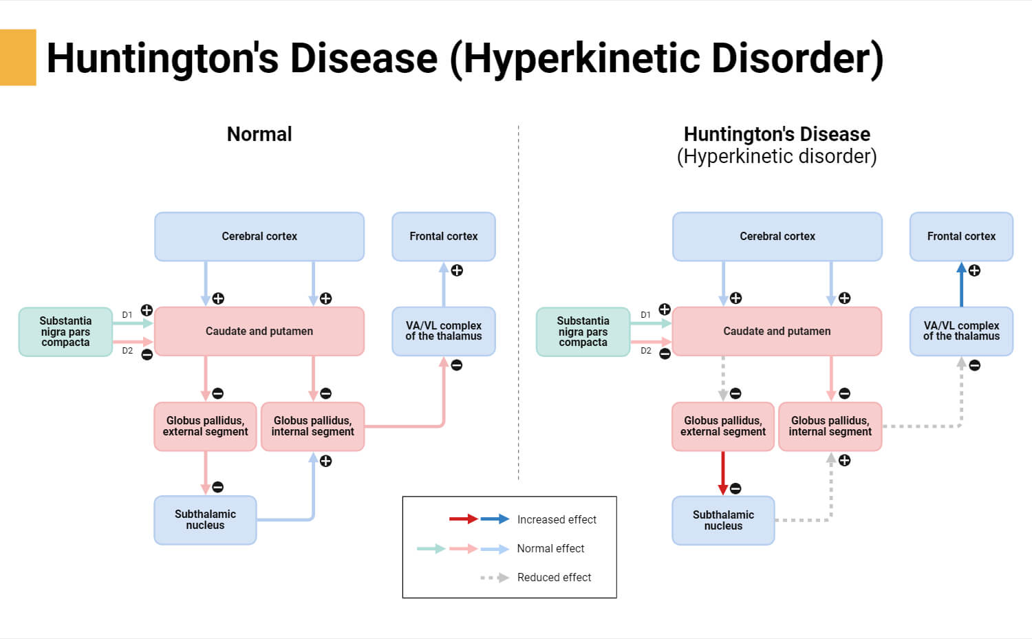 Huntington's Disease (Hyperkinetic Disorder)