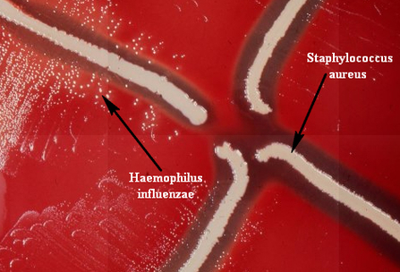 Haeemophilus influenzae Haeemophilus influenzae