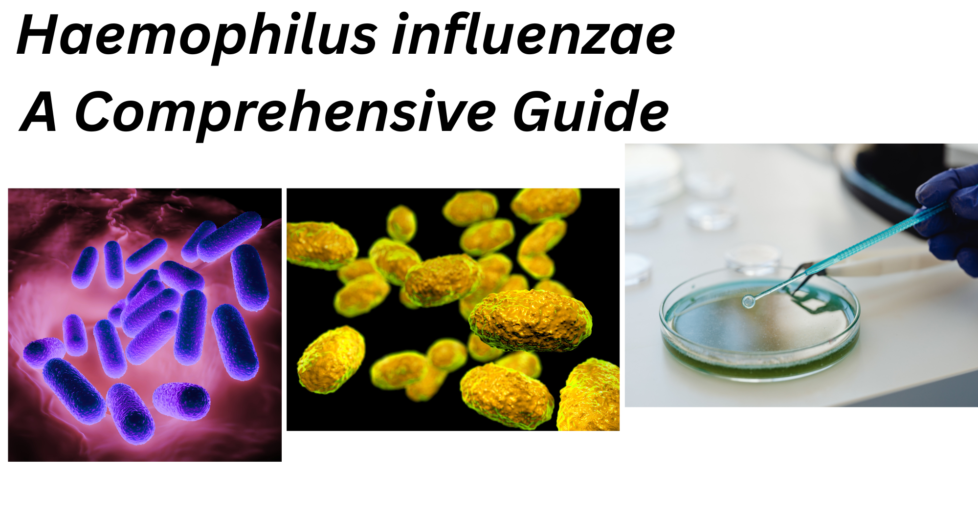 Haemophilus influenzae Haemophilus influenzae