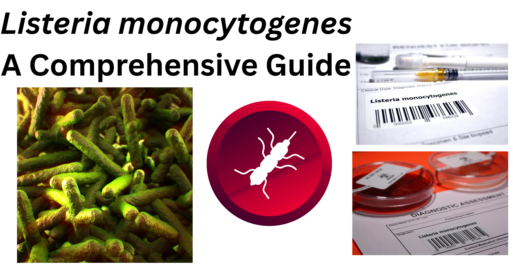 Listeria monocytogenes Listeria monocytogenes