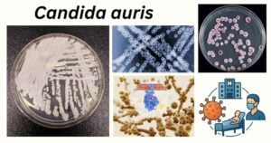 Candida auris 1 Candida auris