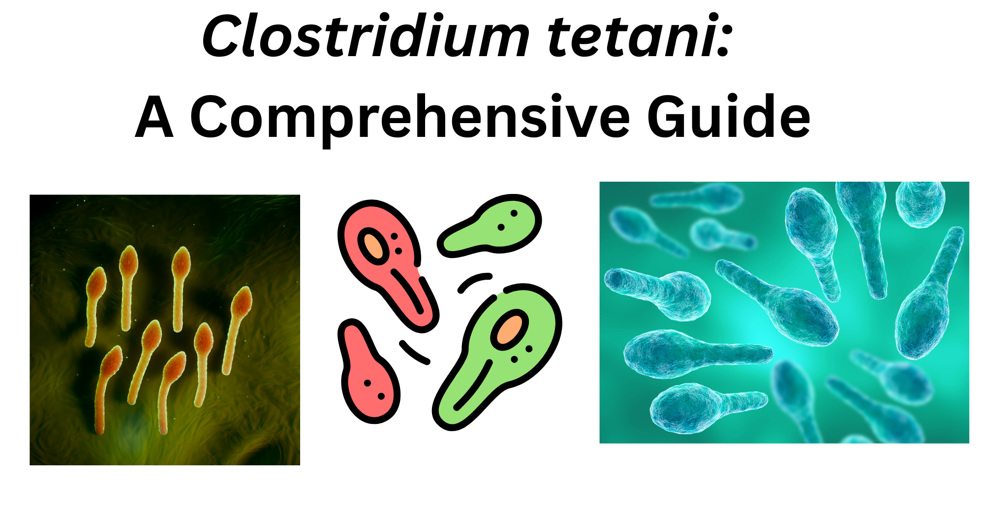 Clostridium tetani Clostridium tetani