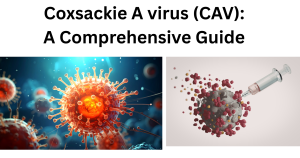 Coxsackie A virus CAV _Coxsackie A virus (CAV)