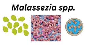 Malassezia spp Malassezia spp.