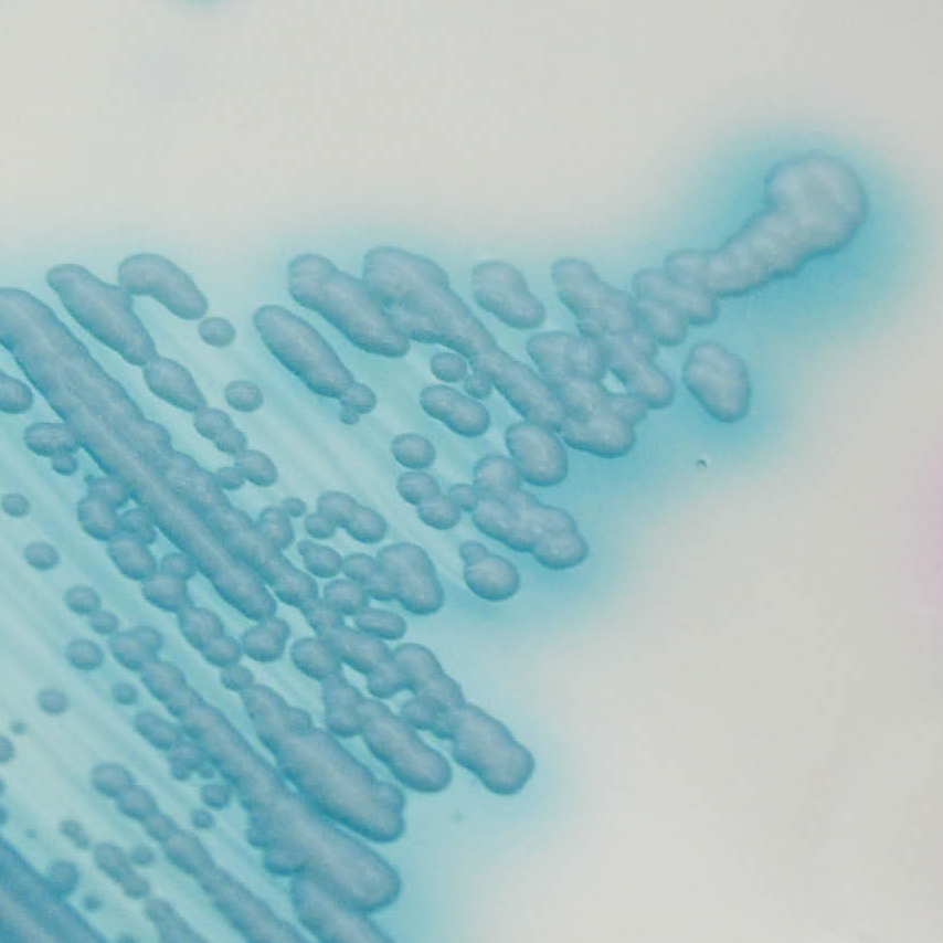 image 107 Light blue colonies of C. auris