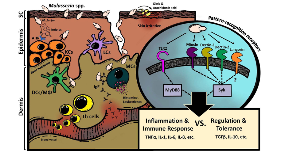 image 108 Host response to Malassezia spp.